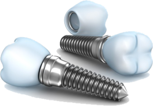 When is it too late to get dental implants 2 Dental Implants Bethesda Chevy Chase MD
