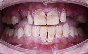 bna-sample