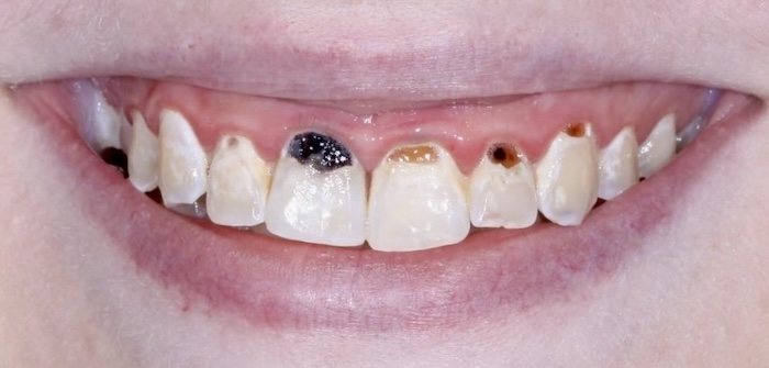 Before