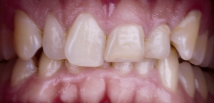 bna-sample